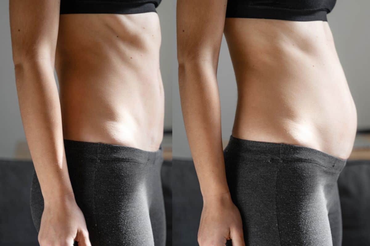 How long does diastasis recti take to improve Brent Park?