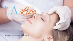 Woman receiving Actinic Keratosis Removal Treatment Brent Park