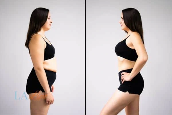 LA-EMS Body Sculpting Brent Park results before and after of womans results on body toning.