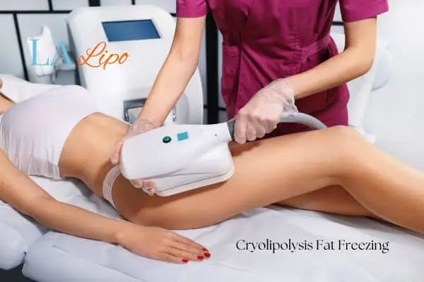 Woman receiving coolsculpting Brent Park treatment on her thighs