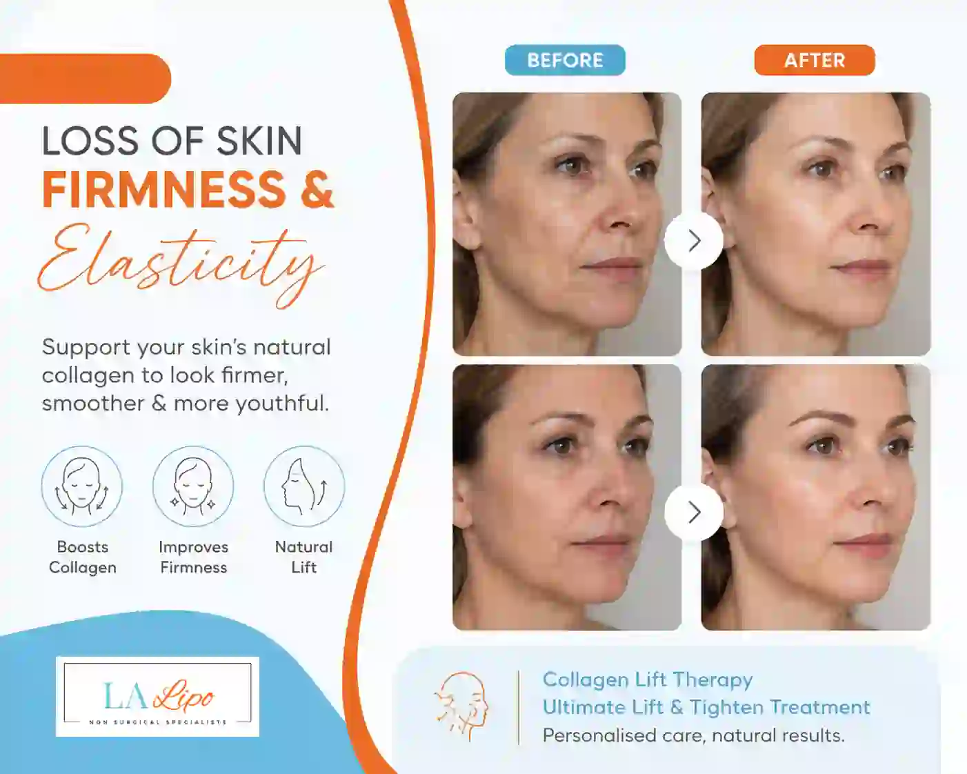 Sign #7: Loss of Skin Firmness and Elasticity Brent Park